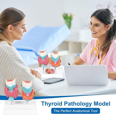 jnmftd نموذج تشريح أمراض الغدة الدرقية البشرية، حجم الحياة 4 أجزاء الغدة الدرقية التشريحية انفصال الغدة الدرقية مرض الغدة الدرقية مع بطاقة دليل قاعدة البلاستيكية القابلة للإزالة للدراسة الطبية علم وظائف الأعضاء التعليم in Kuwait
