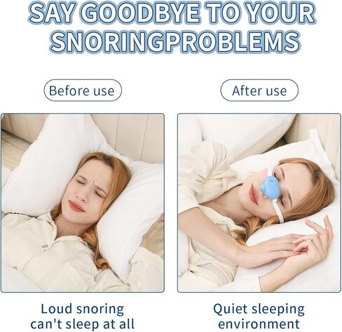 Smart Anti-Snoring Device,Smart Snore Stopper with Strong and Weak Modes for Snoring Reminder,Relief.Easy Use,AI Automatic Monitoring Portable Snore Solution for Home Office Travel in Saudi Arabia