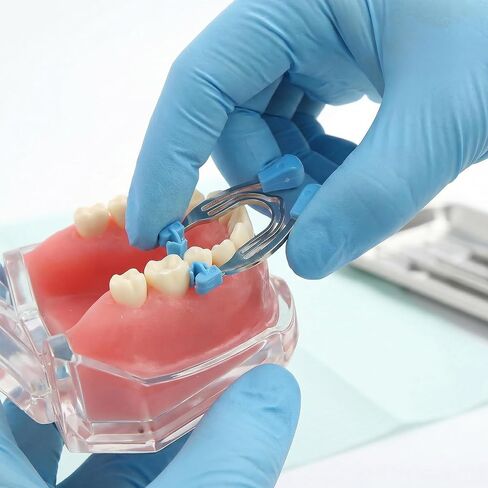 Dental Matrix System Sectional Contoured Matrices Metal Clips Clamps Autoclave Spring Clip Rings(Type C） in Kuwait