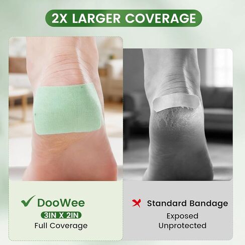 DooWee 50 قطعة كبيرة من رقعة الصبار للبشرة المتشققة مقاس 3 × 2 بوصة ضمادات ترطيب واسعة للغاية للكعوب الجافة المتشققة والأيدي وأطراف الأصابع، رقع قطنية قابلة للتنفس خالية من الفوضى لإصلاح مكثف in Kuwait