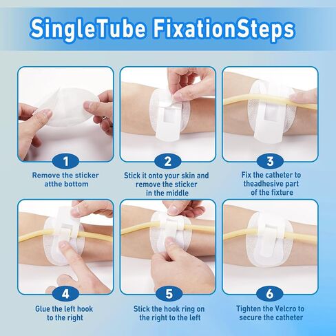 12 Pcs Foley Catheter Stabilization Device, Urinary Leg Bag Catheter Tube Holder Catheter Supplies for PEG/G/Feeding Tube Holder Accessories, Adhesive Catheter Urinary Leg Bags Holder in Saudi Arabia