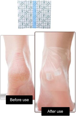 50 حزمة من رقع الكعب المتشققة لإصلاح الكعب المتشقق، أشرطة حماية للترطيب، أشرطة لاصقة للوقاية من البثور، ملصقات للكعب لعلاج الأقدام الجافة المتشققة، مرهم لشفاء الجلد in Kuwait