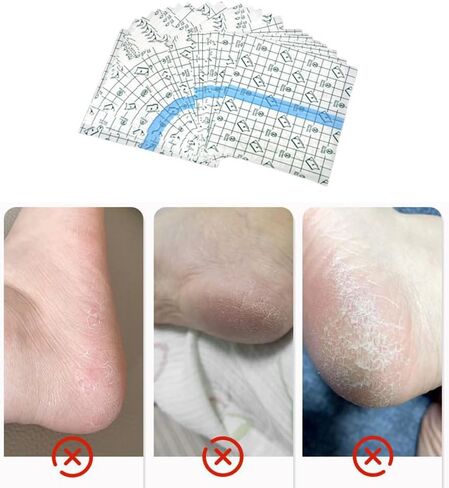 50 حزمة من رقع الكعب المتشققة لإصلاح الكعب المتشقق، أشرطة حماية للترطيب، أشرطة لاصقة للوقاية من البثور، ملصقات للكعب لعلاج الأقدام الجافة المتشققة، مرهم لشفاء الجلد in Kuwait