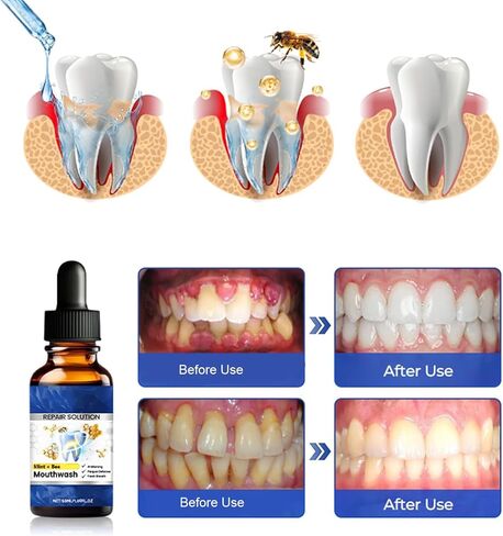قطعتان من محلول إصلاح الفم من بيتاكت، غسول الفم بنكهة النعناع، ​​يحسن بشكل فعال صحة الفم والنفس المنعش طويل الأمد، محلول العناية اليومية بالفم in Kuwait