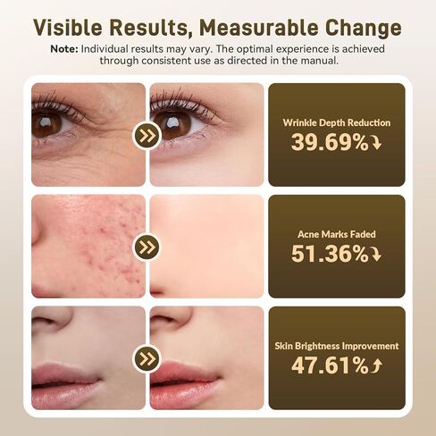 HSA FSA Gracekey Red Light Therapy for Face, 4-in-1 Colors LED Facial Light Therapy Mask, Dual 2000mAh Rechargeable Light Therapy with Timer for Home Use in Saudi Arabia