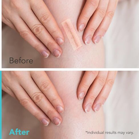 ضمادات غرواني مائي للعناية بالجروح، بكرة شريط غرواني مائي كبيرة جدًا بحجم 2 × 12 قدمًا، مع ذاتية اللصق، مقطوعة حسب الحجم، فائقة الامتصاص، مرنة ومقاومة للماء، مجموعة الإسعافات الأولية الأساسية in Kuwait