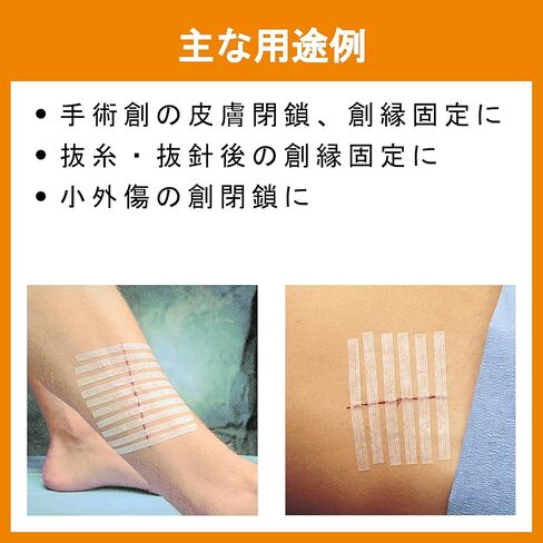 3M Healthcare Steri-Strip 1/4" x 4"، فئة معززة: الضمادات المتخصصة، منتجات العناية بالجروح (10 شرائط) in Saudi Arabia