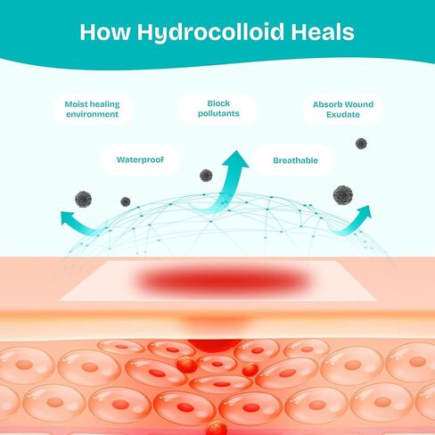 Hydrocolloid Wound Care Roll, Waterproof 2in x 16.5ft, Extra Large Cut-to-Size Self-Adhesive Bandages for Blister, Scar, Pimple, First Aid Essential in Saudi Arabia