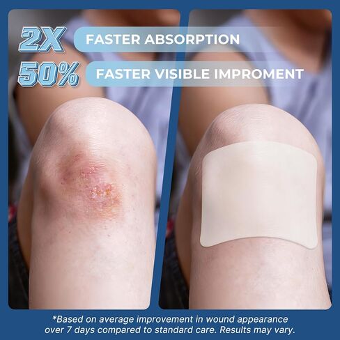 Medical Grade Hydrocolloid Roll 2 Inch x 20FT – Extra Long Waterproof Self-Adhesive Hydrocolloid Tape for Wound Care, Blisters, First Aid, Burn Dressing & Large Acne Patch Treatment in Saudi Arabia