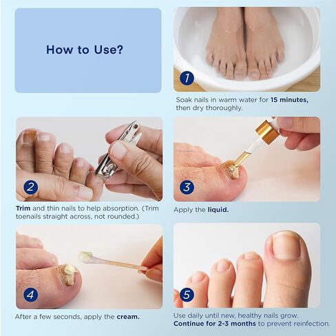 Toenail Fungus Treatment Extra Strength: Nail Fungus Treatment for Toenail and Fingernails - Fungus Nail Treatment Liquid 15ML and Anti-fungal Nail Repair Cream 20g Plant Extract Ingredients in Saudi Arabia