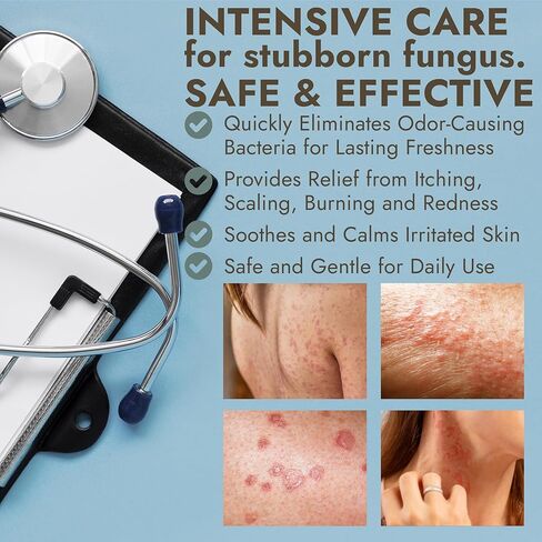 Tinea Versicolor Treatment Antifungal Cream | Relieves Itchy Skin, Ringworm, Jock Itch, Athlete’s Foot & Body Odor, Enriched with Manuka Honey & Tea Tree Oil 120 ml in Kuwait