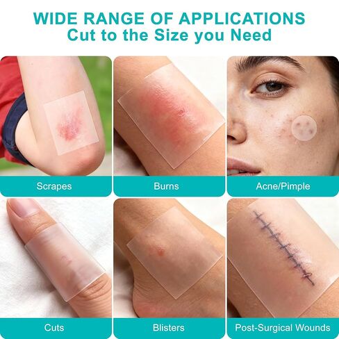 Hydrocolloid Roll for Wound Care, Medical-Grade Hydrocolloid Bandages with Self-Adhesive, Cut-to-Size Patch Bandages, Ultra Absorbent, Waterproof, First Aid Kit Essential (2in*4.8ft) in Saudi Arabia