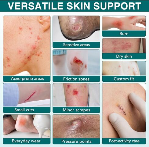 Hydrocolloid Roll Gel Bandages for Wounds: Extra Large Waterproof Hydrocolloid Patches for Wound Care, Flexible & Waterproof DIY Size & Shape(2in * 11.8FT) in Kuwait