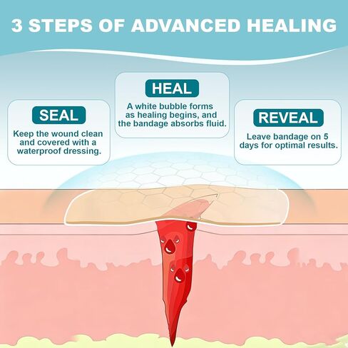 Dodanros Advanced Fast Healing Large Hydrocolloid Gel Bandages, Adhesive Wound Care Pads, 3.07 * 2.32 in （15 Count） in Kuwait