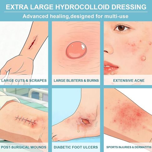 Dodanros Advanced Fast Healing Large Hydrocolloid Gel Bandages, Adhesive Wound Care Pads, 3.07 * 2.32 in （15 Count） in Kuwait