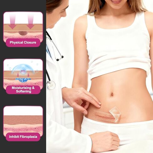 Silicone Scar Sheets Medical Grade Silicone Scar Tape for Surgical Scars 1.77" x 157" 4M Wider Silicone Tape for Keloid Scars, Hypertrophic, C-Section, Tummy Tuck, Surgery and Burn Scar Patches in Kuwait