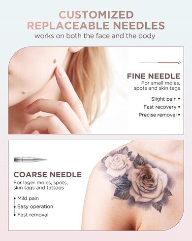 Skin Tag Remover - Skin Tag and Mole Remover for Home Use, Portable Removal Kit for Mole, Wart and Skin Tag for Women and Girls in Kuwait