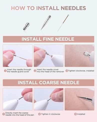 Skin Tag Remover - Skin Tag and Mole Remover for Home Use, Portable Removal Kit for Mole, Wart and Skin Tag for Women and Girls in Kuwait