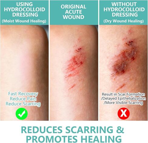 Hydrocolloid Roll for Wound Care, 19.7ft Large Medical Grade Hydrocolloid Roll with Self-Adhesive, Ultra Absorbent, Waterproof, Flexible, DIY Size First Aid Kit Essential (2in x 9.84ft, 2Rolls) in Saudi Arabia
