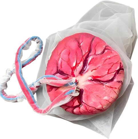 Placenta Umbilical Cord Anatomical Model, Life-Size Female Childbirth Education Model with Both Amniotic and Chorionic Membranes for Obstetrics and Gynecology Midwifery Teaching in Saudi Arabia
