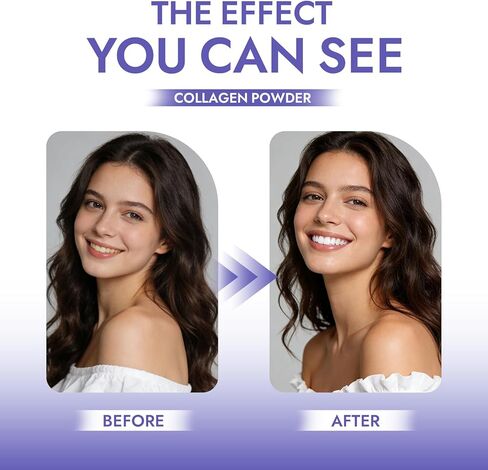 Nudent CollaSmile مسحوق أسنان بالكولاجين مع هيدروكسيباتيت - مسحوق معجون أسنان لتقوية المينا من أجل لثة صحية، تركيبة طبيعية للعناية بالفم in Kuwait