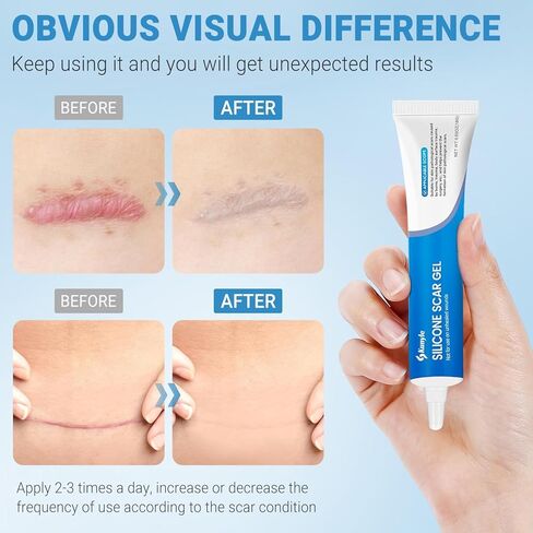 جل الندبات السيليكون، كريم الندبات، عصا الندبات المتقدمة للندبات الجراحية، علامات التمدد، إزالة نتوءات الجدرة، الندبات القديمة والجديدة 0.63 أونصة (18 جم) in Kuwait