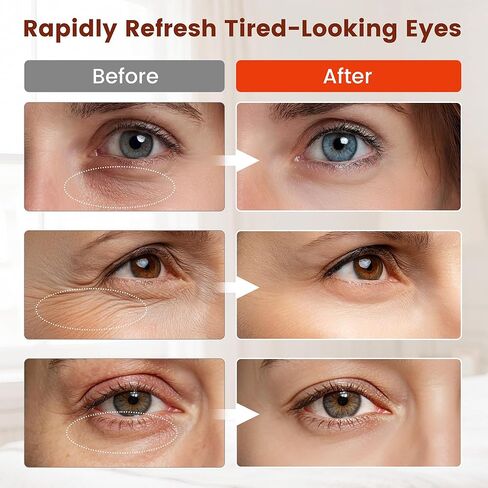 العلاج بالضوء الأحمر للعيون، العلاج بالضوء الأحمر بالأشعة تحت الحمراء لحقيبة العين، عدم تسرب الضوء 630 نانومتر الضوء الأحمر و850 نانومتر جهاز العلاج بالضوء الأحمر بالأشعة تحت الحمراء للتجاعيد، قناع العين بالضوء الأحمر مع جهاز تحكم عن بعد قابل لإعادة الشحن in Kuwait