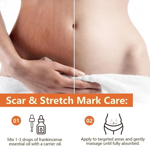 Frankincense Essential Oil 60ml in Kuwait