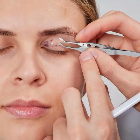 iplusmile Meibomian Gland Expressor، ملقط تعبيري من الفولاذ المقاوم للصدأ لتدليك الجفن، أدوات احترافية للعناية بالوجه للعيون الجافة in Saudi Arabia