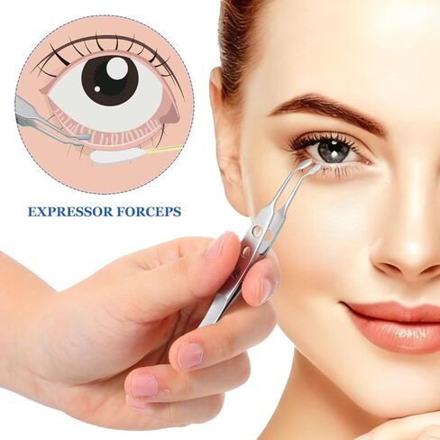 iplusmile Meibomian Gland Expressor، ملقط تعبيري من الفولاذ المقاوم للصدأ لتدليك الجفن، أدوات احترافية للعناية بالوجه للعيون الجافة in Saudi Arabia