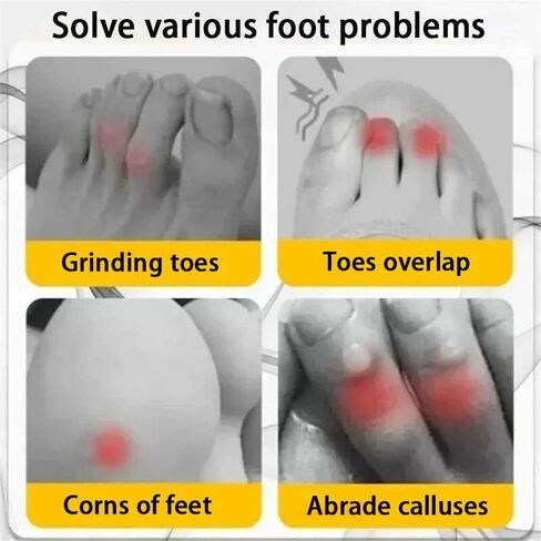 30 Pcs Silicone Toe Protectors, Breathable, Waterproof, and Sweat Proof, Pain Relief, Solve Various Foot Problems in Saudi Arabia