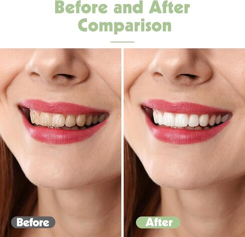 مجموعة فرش أسنان للسفر مكونة من 6 قطع، فرش أسنان ناعمة للغاية للبالغين، فرشاة أسنان يدوية محمولة لطيفة مع حقيبة سفر فردية، فرش أسنان للتنظيف العميق للأسنان الحساسة (متعددة الألوان) in Kuwait