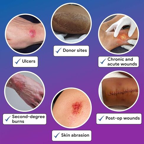 ضمادات فضية رغوية ذات حدود للعناية بالجروح 4 × 4 بوصة - ضمادات رغوية 10 Ag لإفرازات الجروح المتوسطة إلى الثقيلة - عالية الامتصاص ومقاومة للماء in Kuwait