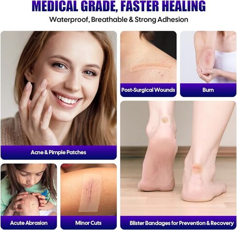 لفة غرواني مائي للعناية بالجروح، بكرة رقعة بثرة ماصة من الدرجة الطبية، ضمادات غرواني مائي مع ذاتية اللصق، مقاومة للماء، مجموعة الإسعافات الأولية بحجم وشكل DIY أساسية (2 بوصة * 4.8 قدم) in Saudi Arabia