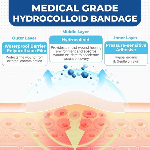 Hydrocolloid Roll for Wound Care, 2in x 12ft, Medical Grade Hydrocolloid Bandages, Pimple Patch Roll, Colloidal Dressing Tape for Acne, Blister, Burn, Scrapes, Cut to Size, Waterproof, Large in Kuwait