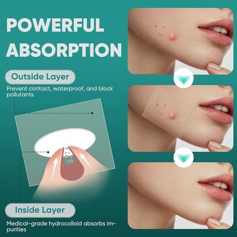 2in x 16.5ft Hydrocolloid Roll,100 Pcs Pre-Cut Pimple Patches Roll, Cut-to-Size Hydrocolloid Acne Patches for Face & Body, Vegan, Cruelty-Free & Invisible, Zit Covers for Chin, Back, Forehead in Saudi Arabia