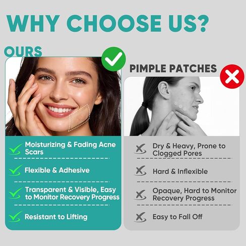 2in x 16.5ft Hydrocolloid Roll,100 Pcs Pre-Cut Pimple Patches Roll, Cut-to-Size Hydrocolloid Acne Patches for Face & Body, Vegan, Cruelty-Free & Invisible, Zit Covers for Chin, Back, Forehead in Saudi Arabia