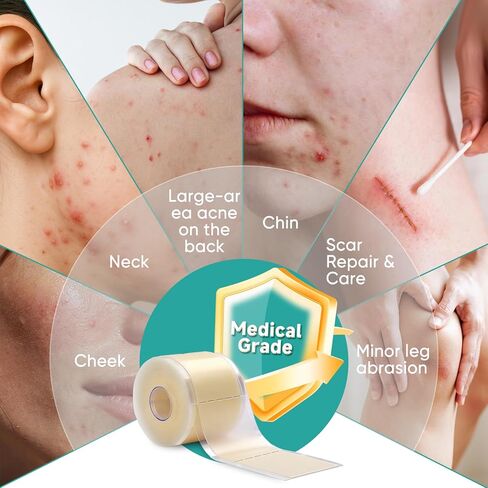 2in x 16.5ft Hydrocolloid Roll,100 Pcs Pre-Cut Pimple Patches Roll, Cut-to-Size Hydrocolloid Acne Patches for Face & Body, Vegan, Cruelty-Free & Invisible, Zit Covers for Chin, Back, Forehead in Saudi Arabia