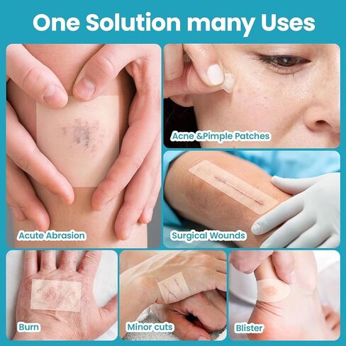 Hydrocolloid Roll for Wound Care: 2IN*6.5FT - Waterproof Ultra Thin Self Adhesive Patch for Blisters Acne Bedsores Pressure Diabetic Ulcers - DIY Size - Home First Aid Kit Essential in Saudi Arabia