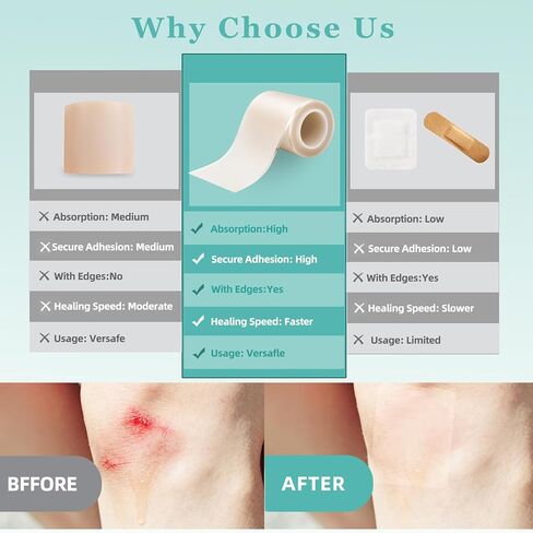 Medical Grade Hydrocolloid Roll for Wound Care with Edges,Hydrocolloid Tape Waterproof Pimple Patches Tape Absorbent Large Hydrocolloid Patch for Acne Patches,Blisters,Burns,Bed Sore and Minor Cuts in Saudi Arabia