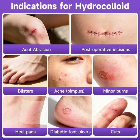 Hydrocolloid Roll for Wound Care, Hydrocolloid Bandages with Self-Adhesive, Flexible & Waterproof DIY Size & Shape（2in*5ft） in Saudi Arabia
