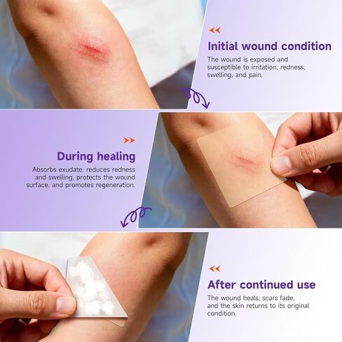 Hydrocolloid Roll for Wound Care, Hydrocolloid Bandages with Self-Adhesive, Flexible & Waterproof DIY Size & Shape（2in*5ft） in Saudi Arabia