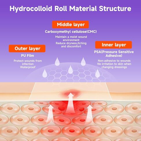 Hydrocolloid Roll for Wound Care, Hydrocolloid Bandages with Self-Adhesive, Flexible & Waterproof DIY Size & Shape（2in*5ft） in Saudi Arabia