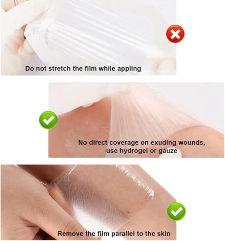 ضمادة فيلم شفاف 50 عبوة 2.4 بوصة × 2.8 بوصة غطاء لاصق مقاوم للماء لضمادات الجروح الشفافة لدرع IV واقي الدش للعناية اللاحقة بالوشم معقم وقابل للتنفس in Kuwait