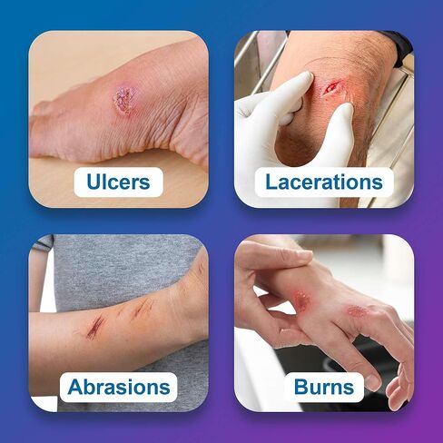 ضمادة جروح ألجينات الكالسيوم الفضية من AG، مقاس 2 × 2 بوصة - 10 وسادات معقمة وغير لاصقة وعالية الامتصاص لإفرازات الجروح - جيدة للقرحة والتمزقات والسحجات والحروق الطفيفة in Kuwait