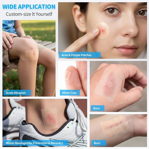 لفافة ضمادات غرواني مائي مقاس 4 × 80 بوصة، لفافة غرواني مائي للعناية بالجروح، 20 قطعة ضمادات رفيعة للغاية مقاس 4 × 4 بوصة مع لاصق ذاتي (قص حسب الحجم)، تضميد جروح غرواني مائي، معقمة ومقاومة للماء in Kuwait