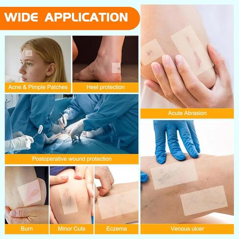 Hydrocolloid Roll Bandage with Pre-Cut 2"x2" Patches - Waterproof & Hypoallergenic for Sensitive Skin - Clear Self-Adhesive Wound Dressing for Acne, Blisters, Burns - 2IN x 4.8FT in Saudi Arabia