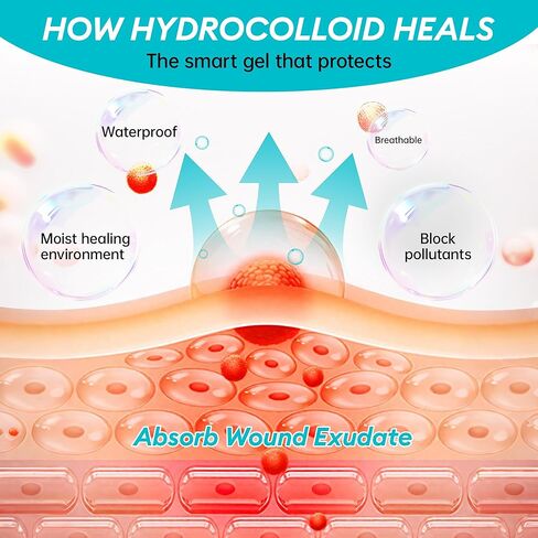 2IN*16.4FT Hydrocolloid Roll for Acne & Scarring,Large Hydrocolloid Patch Bandages with Self-Adhesive,Hydrocolloid Gel Bandages for Wound Care-Scratch-Blisters,Sterile and Waterproof in Saudi Arabia