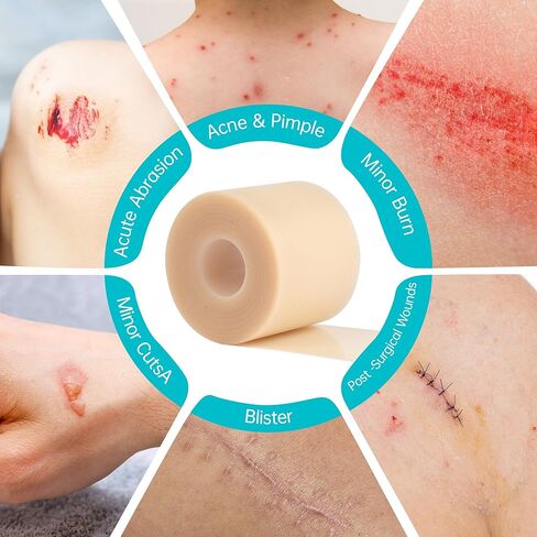 2IN*16.4FT Hydrocolloid Roll for Acne & Scarring,Large Hydrocolloid Patch Bandages with Self-Adhesive,Hydrocolloid Gel Bandages for Wound Care-Scratch-Blisters,Sterile and Waterproof in Saudi Arabia