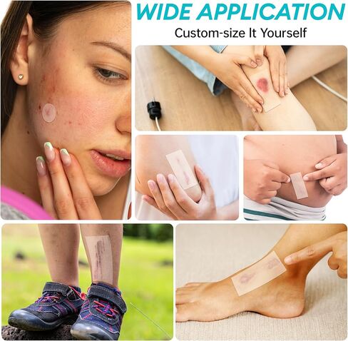 2IN*16.4FT Hydrocolloid Roll for Acne & Scarring,Large Hydrocolloid Patch Bandages with Self-Adhesive,Hydrocolloid Gel Bandages for Wound Care-Scratch-Blisters,Sterile and Waterproof in Saudi Arabia